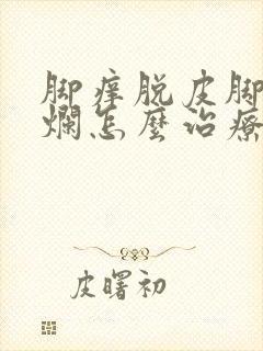 脚痒脱皮脚趾缝烂怎么治疗