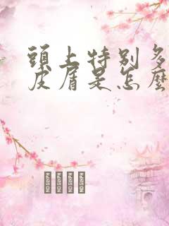 头上特别多的头皮屑是怎么回事