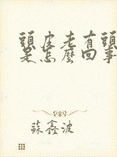 头皮老有头皮屑是怎么回事