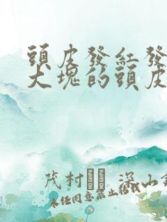 头皮发红发痒有大块的头皮屑怎么办