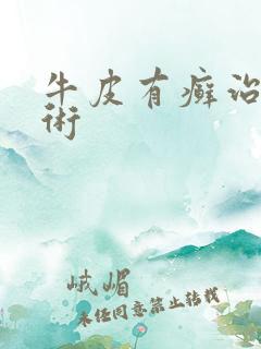 牛皮有癣治疗技术