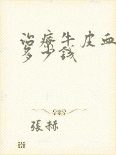 治疗牛皮血癣得多少钱