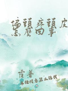 偏头疼头皮疼是怎么回事