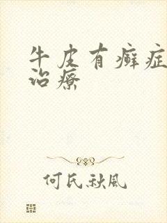 牛皮有癣症怎么治疗