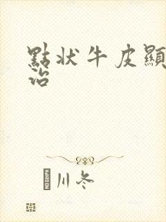 点状牛皮显怎么治