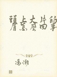 头上大片的头皮屑怎么回事