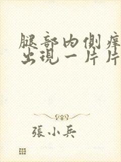 腿部内侧痒一挠出现一片片的疙瘩