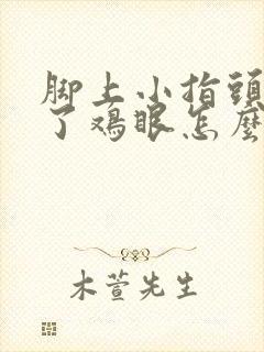 脚上小指头上长了鸡眼怎么治好