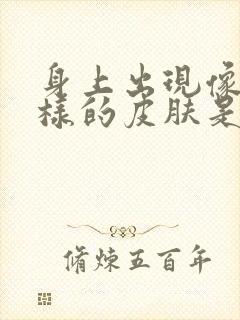 身上出现像癣一样的皮肤是怎么回事