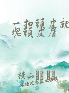 一扣头皮就有大块头皮屑