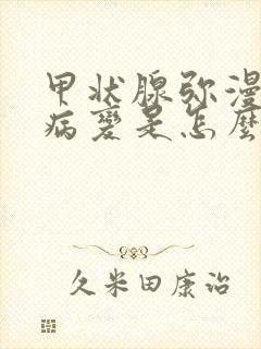 甲状腺弥漫性的病变是怎么回事儿?