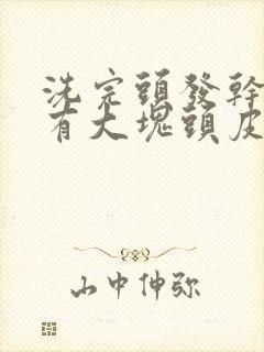 洗完头发干了就有大块头皮屑