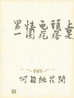 男性龟头上长了一圈疙瘩是什么