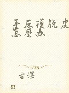 手反复脱皮开裂怎么办