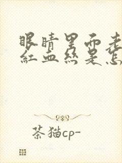 眼睛里面老是有红血丝是怎么回事