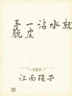 手一沾水就皱还脱皮