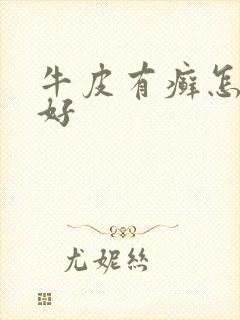 牛皮有癣怎么办好