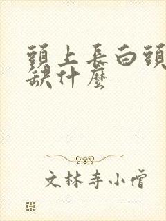 头上长白头发是缺什么