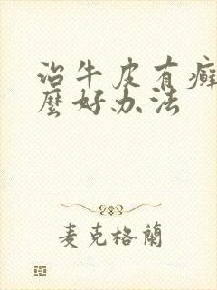 治牛皮有癣有什么好办法