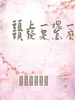 头上一块一块掉头发是怎么回事