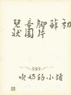 儿童脚藓初期症状图片