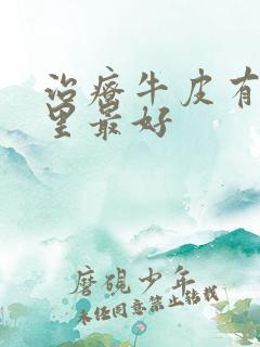 治疗牛皮有癣哪里最好