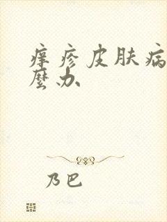 痒疹皮肤病痒怎么办