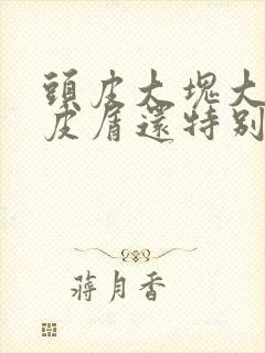 头皮大块大块头皮屑还特别痒怎么办