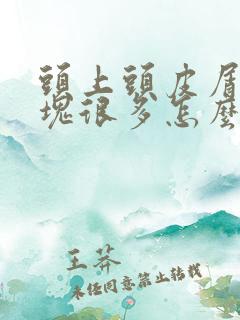 头上头皮屑一大块很多怎么回事