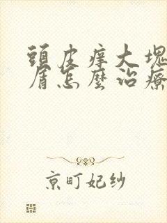 头皮痒大块头皮屑怎么治疗