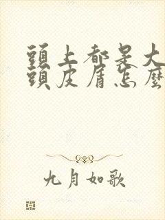 头上都是大块的头皮屑怎么回事