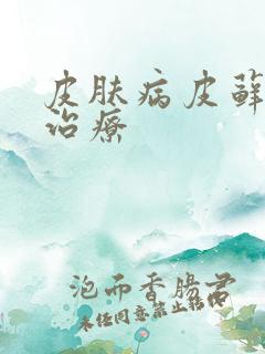 皮肤病皮藓如何治疗