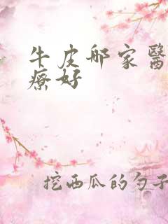 牛皮哪家医院治疗好