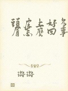 头皮上好多头皮屑怎么回事