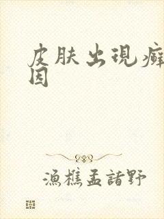 皮肤出现癣的原因