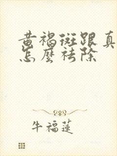 黄褐斑跟真皮斑怎么祛除