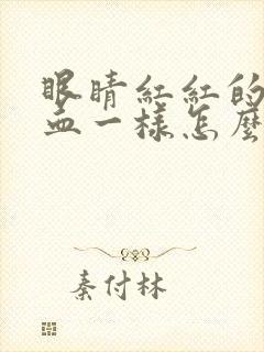 眼睛红红的像出血一样怎么消除