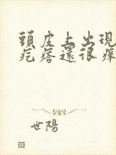 头皮上出现红色疙瘩还很痒怎么回事