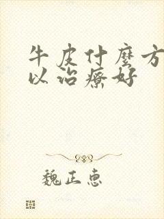 牛皮什么方法可以治疗好
