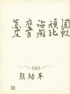 怎么治顽固性牛皮有癣比较好