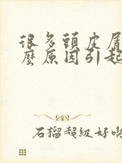 很多头皮屑是什么原因引起的