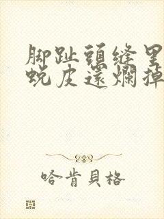 脚趾头缝里很痒蜕皮还烂掉用什么药