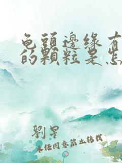 龟头边缘有白色的颗粒是怎么回事