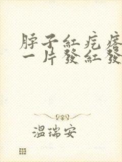 脖子红疙瘩一片一片发红发痒是怎么回事