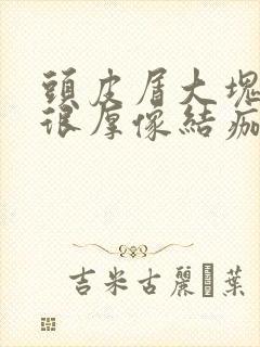 头皮屑大块很硬很厚像结痂