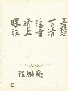 眼睛往下看模糊往上看清楚怎么回事