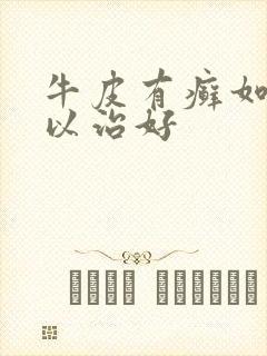 牛皮有癣如何可以治好