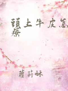 头上牛皮怎么治疗