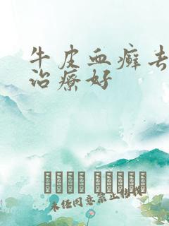 牛皮血癣去哪里治疗好