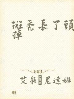 斑秃长了头发又掉